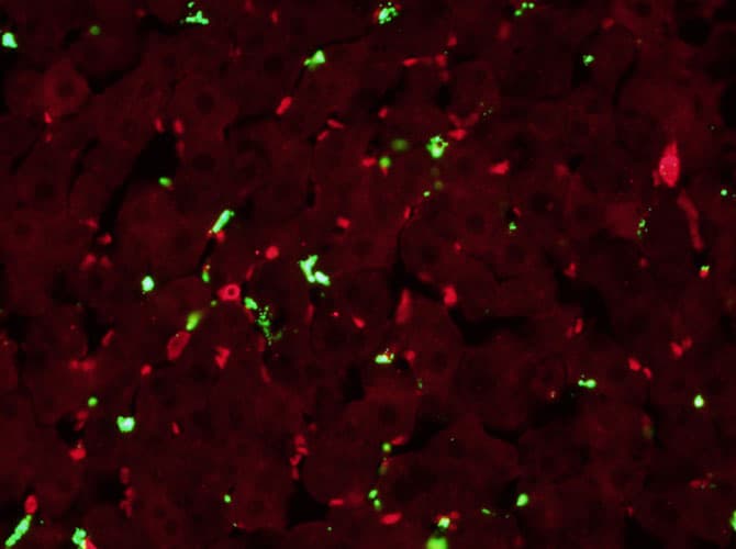 view of neutrophils in red