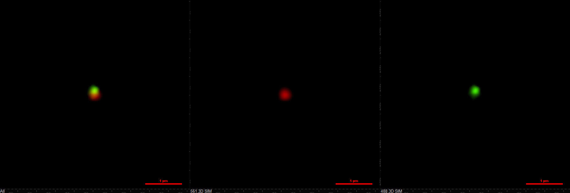 The two-compartment nanoparticles as seen with fluorescence microscopy.