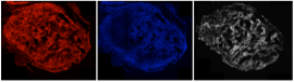 Distribution of three imaging agents within a ~5 mm tumor. The molecular weight, charge, lipophilicity, and target affinity all impact the pattern of uptake within the tumor (above) and surrounding healthy tissue (not shown) affecting the TBR. Images taken by Sumit Bhatnagar.